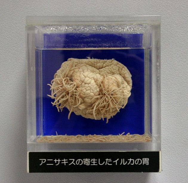 Pickled dolphin brain that's riddled with parasitic worms